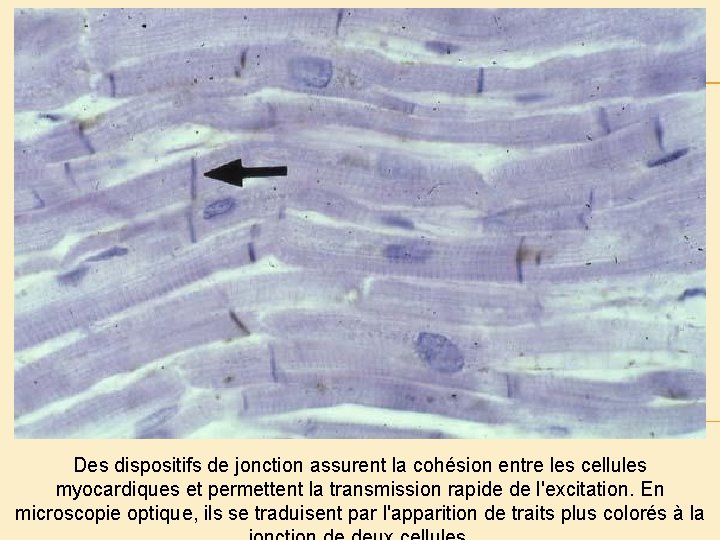 Des dispositifs de jonction assurent la cohésion entre les cellules myocardiques et permettent la