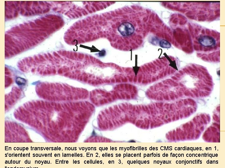 En coupe transversale, nous voyons que les myofibrilles des CMS cardiaques, en 1, s'orientent