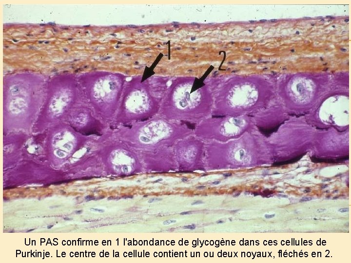 Un PAS confirme en 1 l'abondance de glycogène dans cellules de Purkinje. Le centre