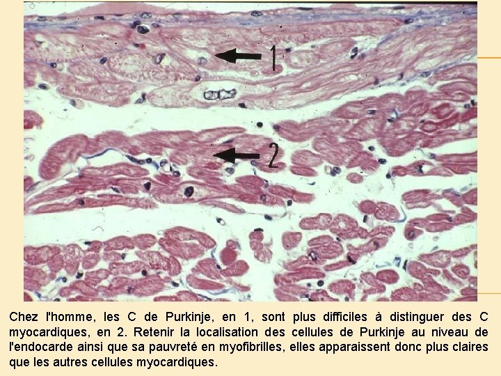 Chez l'homme, les C de Purkinje, en 1, sont plus difficiles à distinguer des