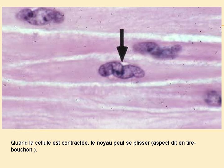 Quand la cellule est contractée, le noyau peut se plisser (aspect dit en tirebouchon