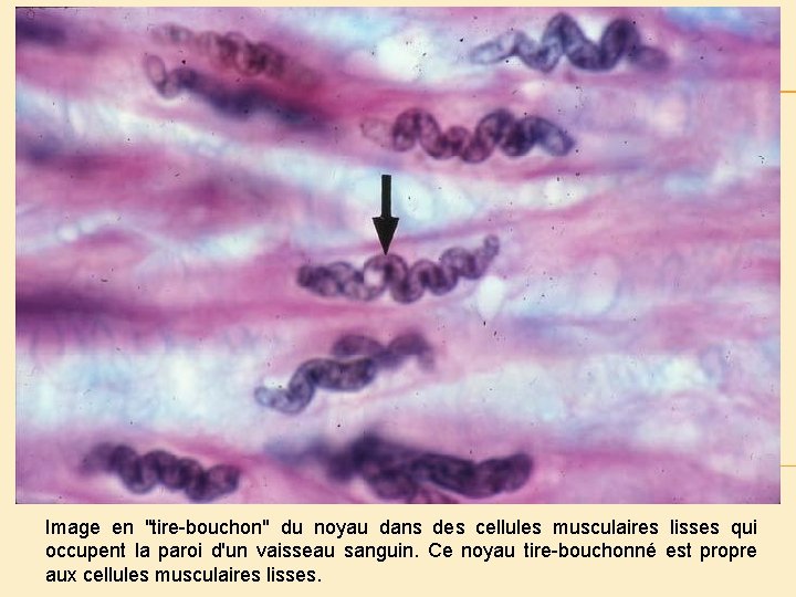 Image en "tire-bouchon" du noyau dans des cellules musculaires lisses qui occupent la paroi