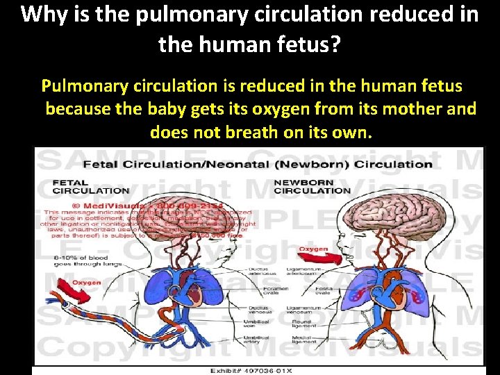 Why is the pulmonary circulation reduced in the human fetus? Pulmonary circulation is reduced Why is the pulmonary circulation reduced in the human fetus? Pulmonary circulation is reduced