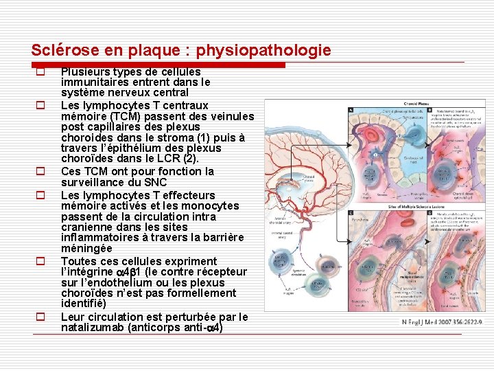 Sclérose en plaque : physiopathologie o o o Plusieurs types de cellules immunitaires entrent Sclérose en plaque : physiopathologie o o o Plusieurs types de cellules immunitaires entrent