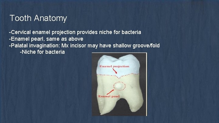 Tooth Anatomy -Cervical enamel projection provides niche for bacteria -Enamel pearl, same as above