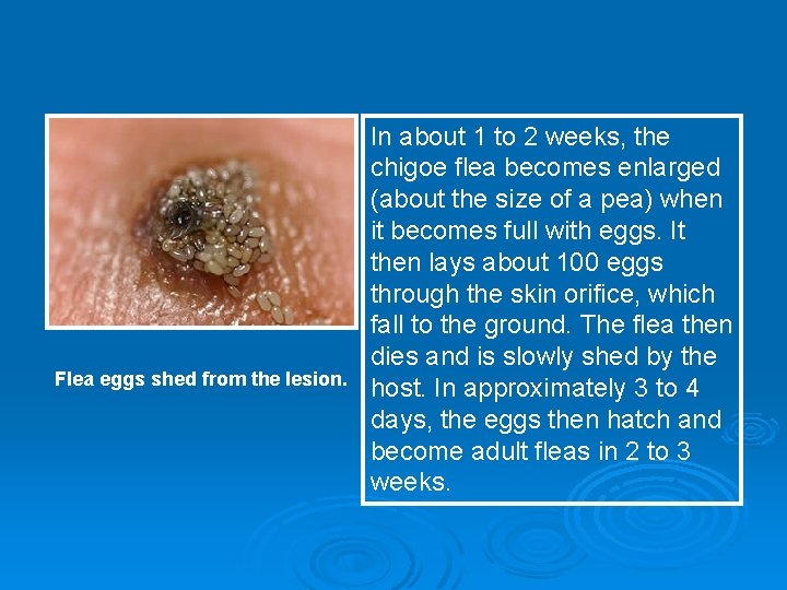 Flea eggs shed from the lesion. In about 1 to 2 weeks, the chigoe