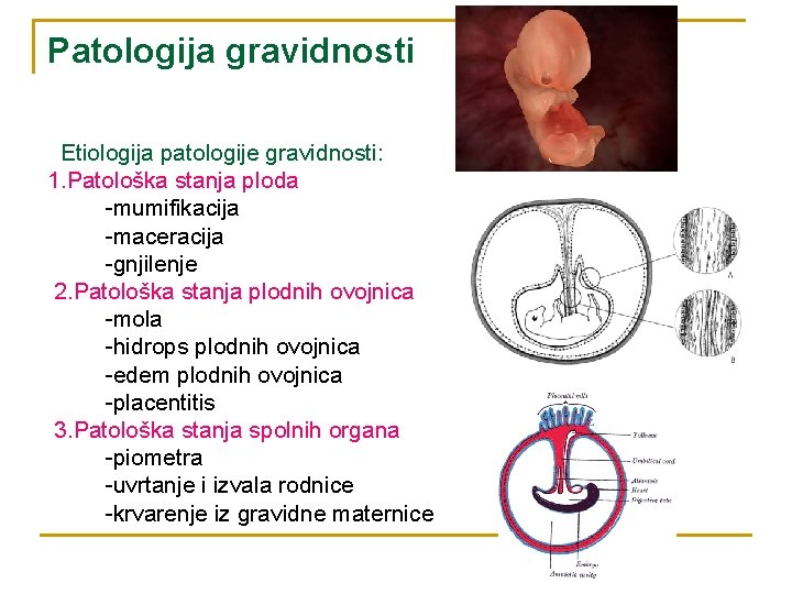 Patologija gravidnosti Etiologija patologije gravidnosti: 1. Patološka stanja ploda -mumifikacija -maceracija -gnjilenje 2. Patološka