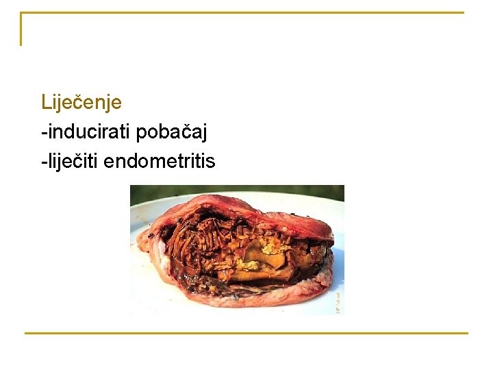 Liječenje -inducirati pobačaj -liječiti endometritis 