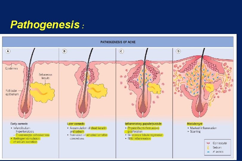 Pathogenesis : 