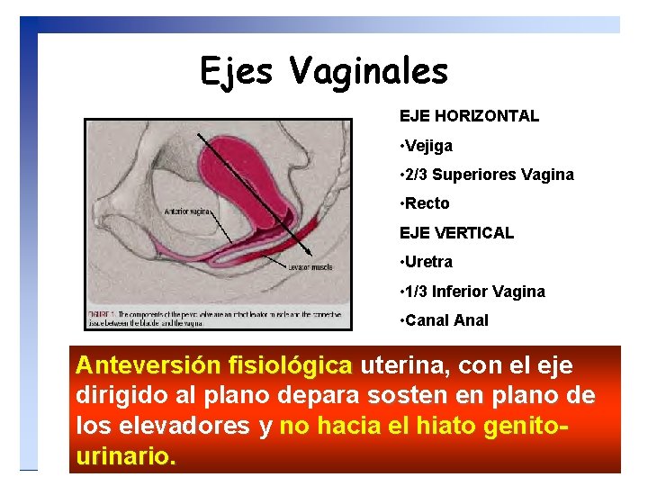 Ejes Vaginales EJE HORIZONTAL • Vejiga • 2/3 Superiores Vagina • Recto EJE VERTICAL