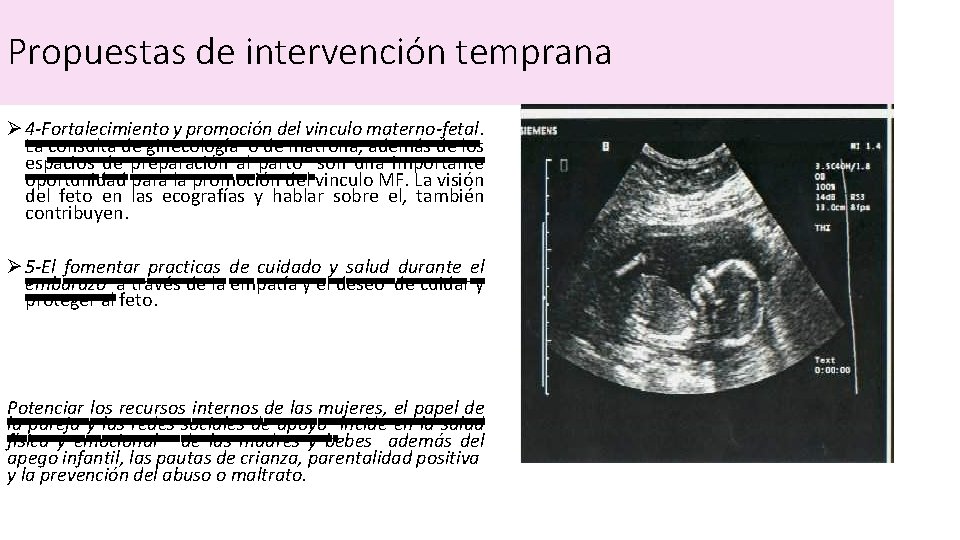 Propuestas de intervención temprana Ø 4 -Fortalecimiento y promoción del vinculo materno-fetal. La consulta