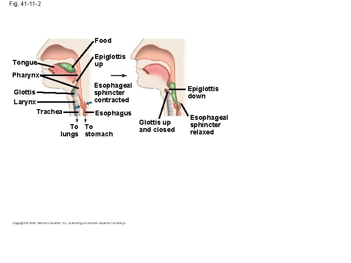 Fig. 41 -11 -2 Food Epiglottis up Tongue Pharynx Esophageal sphincter contracted Glottis Larynx