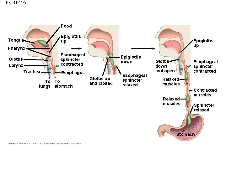 Fig. 41 -11 -3 Food Epiglottis up Tongue Epiglottis up Pharynx Esophageal sphincter contracted