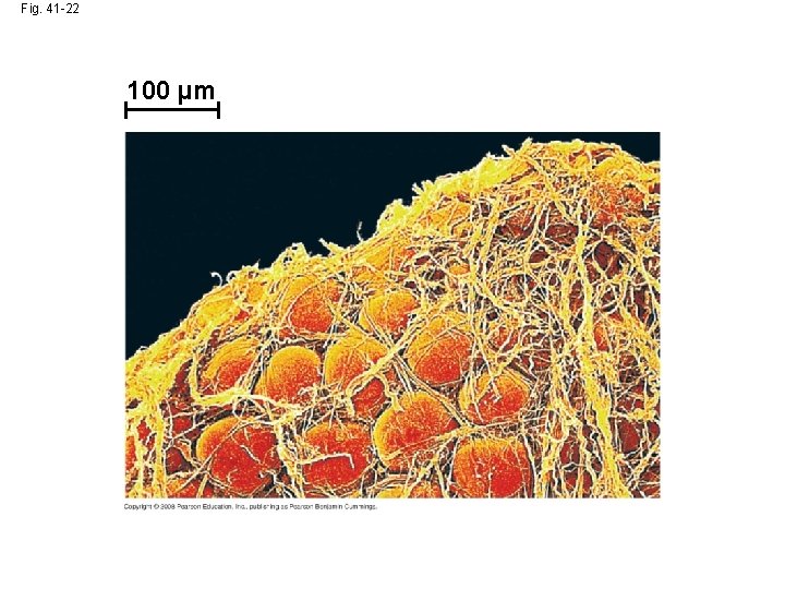 Fig. 41 -22 100 µm 