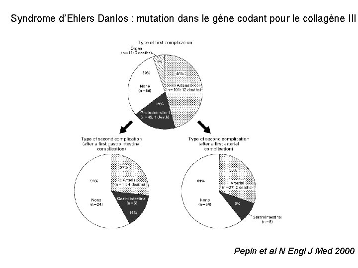 Syndrome d’Ehlers Danlos : mutation dans le gène codant pour le collagène III Pepin