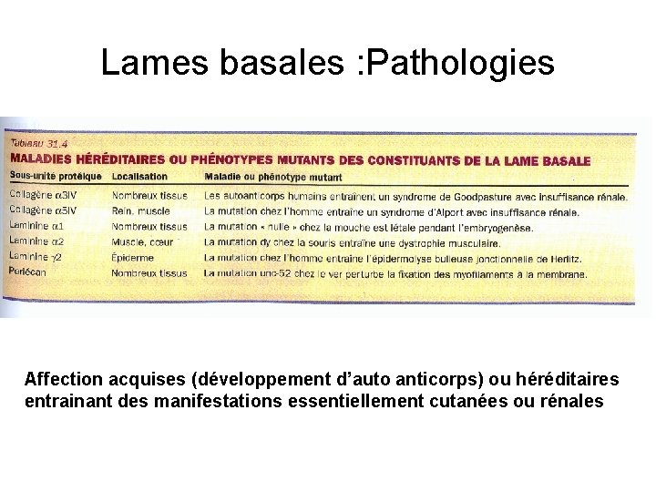 Lames basales : Pathologies Affection acquises (développement d’auto anticorps) ou héréditaires entrainant des manifestations