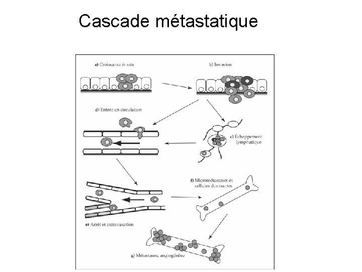 Cascade métastatique 