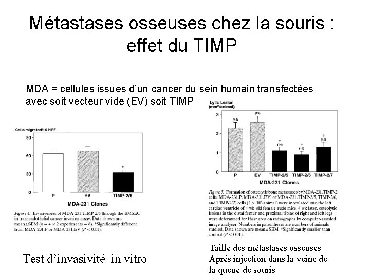 Métastases osseuses chez la souris : effet du TIMP MDA = cellules issues d’un