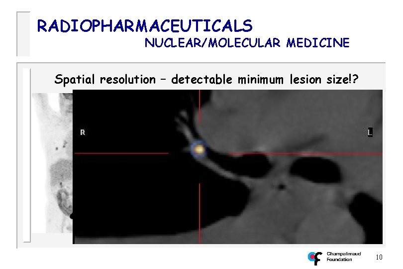 RADIOPHARMACEUTICALS NUCLEAR/MOLECULAR MEDICINE Spatial resolution – detectable minimum lesion size!? 10 