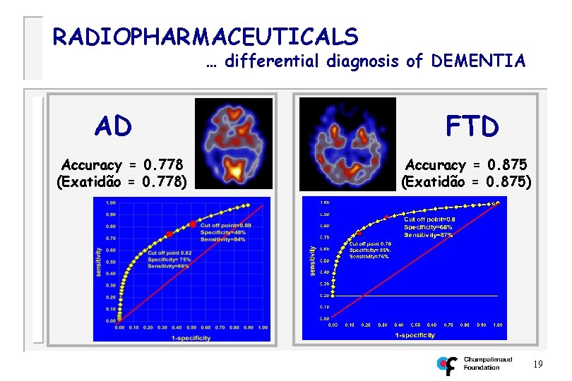 RADIOPHARMACEUTICALS … differential diagnosis of DEMENTIA AD Accuracy = 0. 778 (Exatidão = 0.