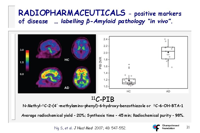 RADIOPHARMACEUTICALS of disease - positive markers … labelling β-Amyloid pathology “in vivo”. 11 C-PIB