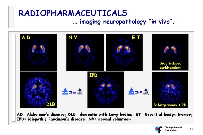 RADIOPHARMACEUTICALS … imaging neuropathology “in vivo”. A D N V E T Drug induced