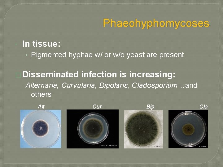 Phaeohyphomycoses • In tissue: • Pigmented hyphae w/ or w/o yeast are present � Phaeohyphomycoses • In tissue: • Pigmented hyphae w/ or w/o yeast are present �