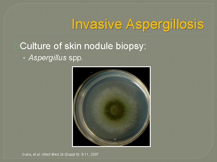 Invasive Aspergillosis �Culture of skin nodule biopsy: • Aspergillus spp. Guha, et al. Infect Invasive Aspergillosis �Culture of skin nodule biopsy: • Aspergillus spp. Guha, et al. Infect