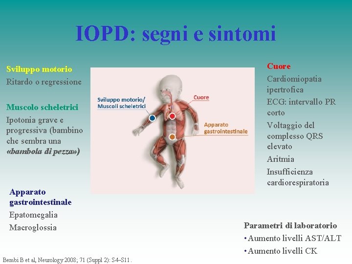 IOPD: segni e sintomi Sviluppo motorio Ritardo o regressione Muscolo scheletrici Ipotonia grave e