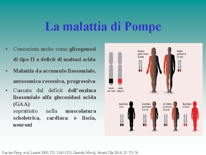 La malattia di Pompe • Conosciuta anche come glicogenosi di tipo II o deficit