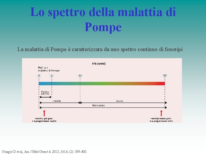 Lo spettro della malattia di Pompe La malattia di Pompe è caratterizzata da uno