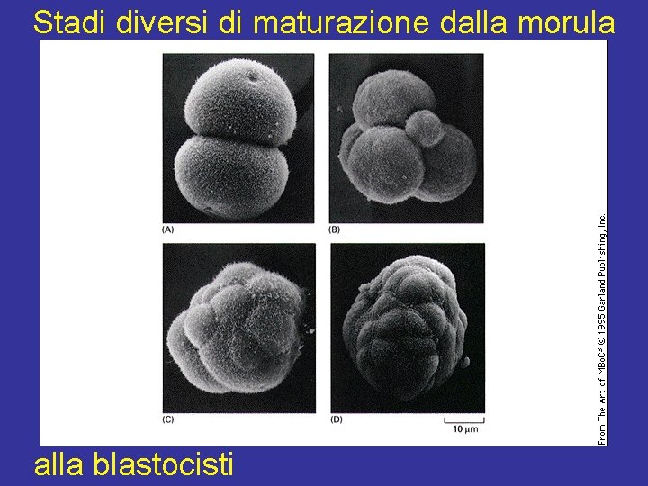 Stadi diversi di maturazione dalla morula alla blastocisti 