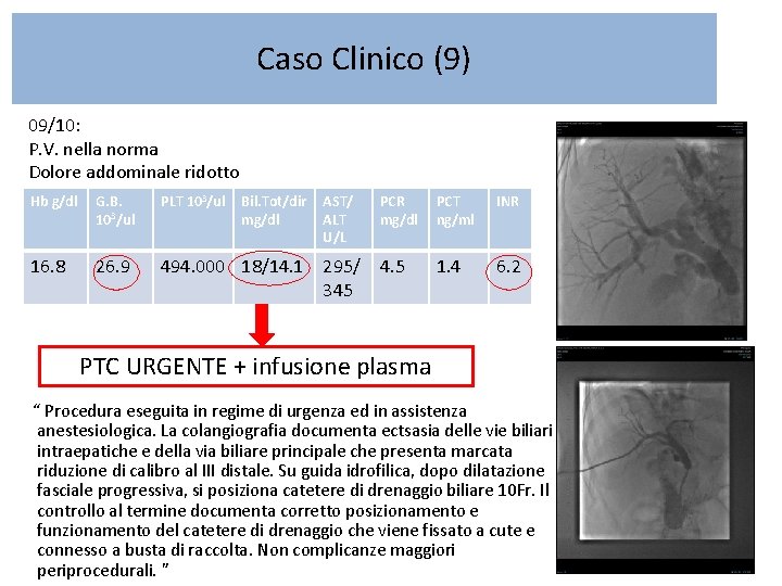 Caso Clinico (9) 09/10: P. V. nella norma Dolore addominale ridotto Hb g/dl G.