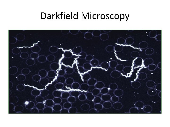 Darkfield Microscopy 