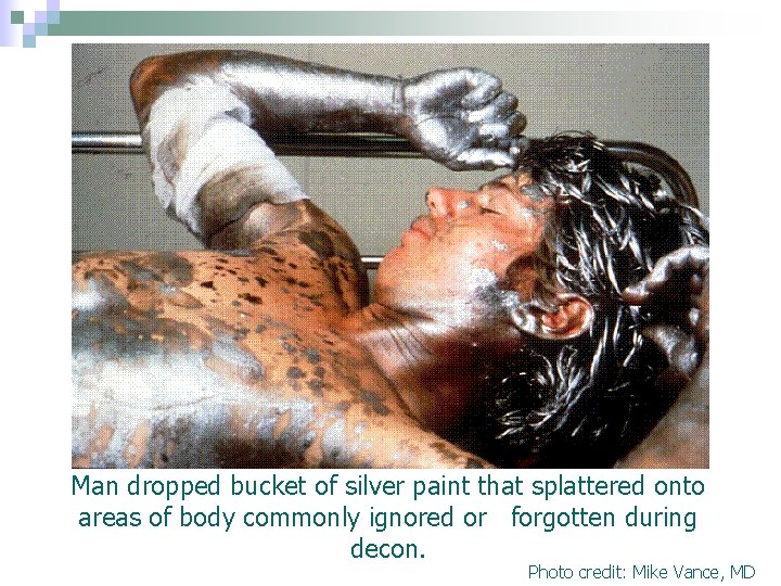 Man dropped bucket of silver paint that splattered onto areas of body commonly ignored Man dropped bucket of silver paint that splattered onto areas of body commonly ignored