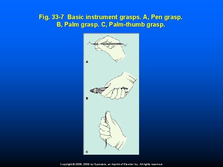 Fig. 33 -7 Basic instrument grasps. A, Pen grasp. B, Palm grasp. C, Palm-thumb