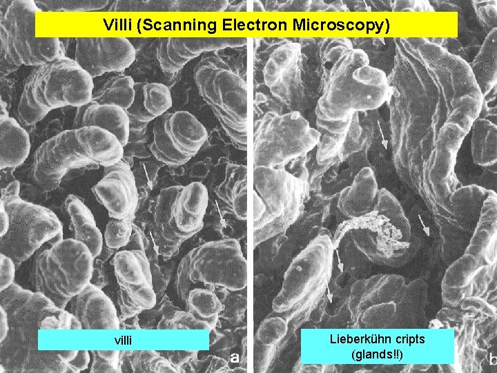 Villi (Scanning Electron Microscopy) villi Lieberkühn cripts (glands!!) 