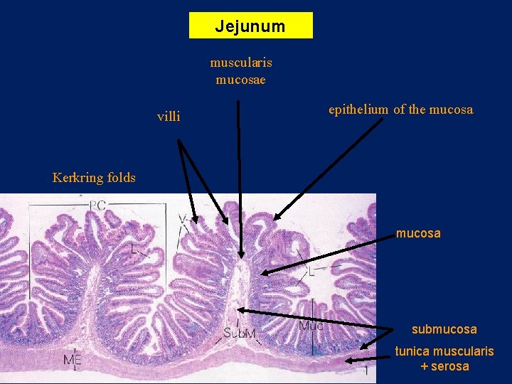 Jejunum muscularis mucosae villi epithelium of the mucosa Kerkring folds mucosa submucosa tunica muscularis