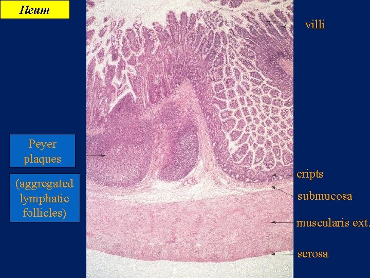 Ileum villi Peyer plaques (aggregated lymphatic follicles) cripts submucosa muscularis ext. serosa 