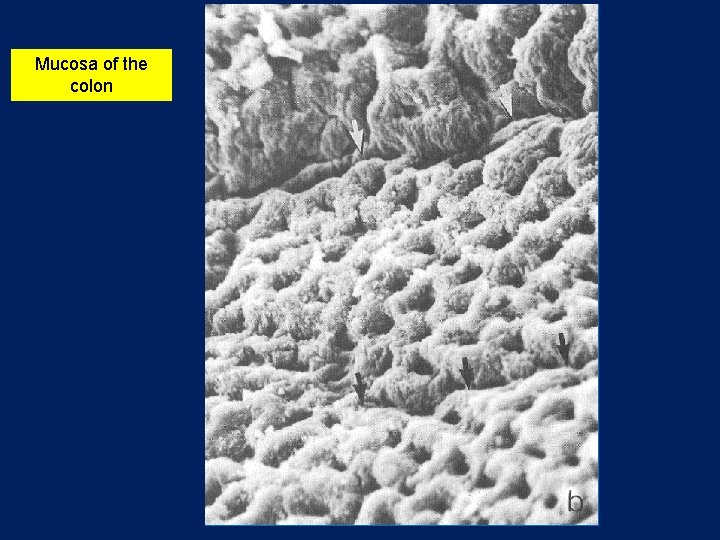 Mucosa of the colon 