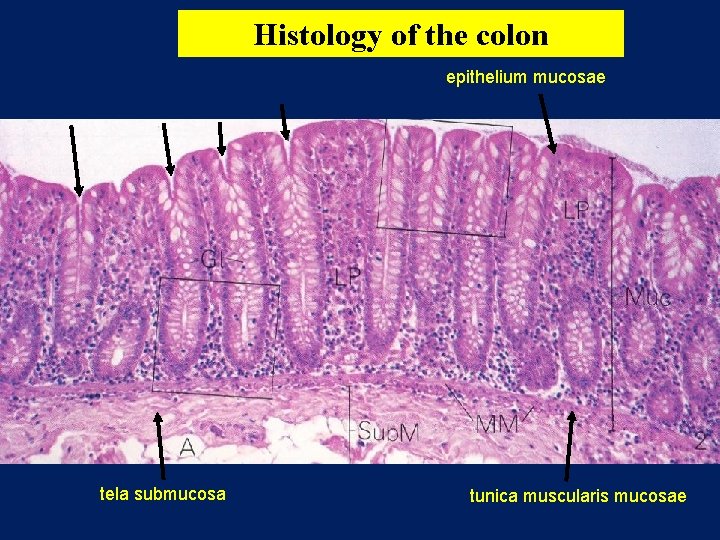 Histology of the colon epithelium mucosae tela submucosa tunica muscularis mucosae 