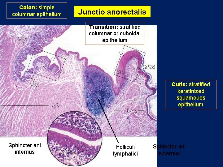 Colon: simple columnar epithelium Junctio anorectalis Transition: stratified columnar or cuboidal epithelium Cutis: stratified