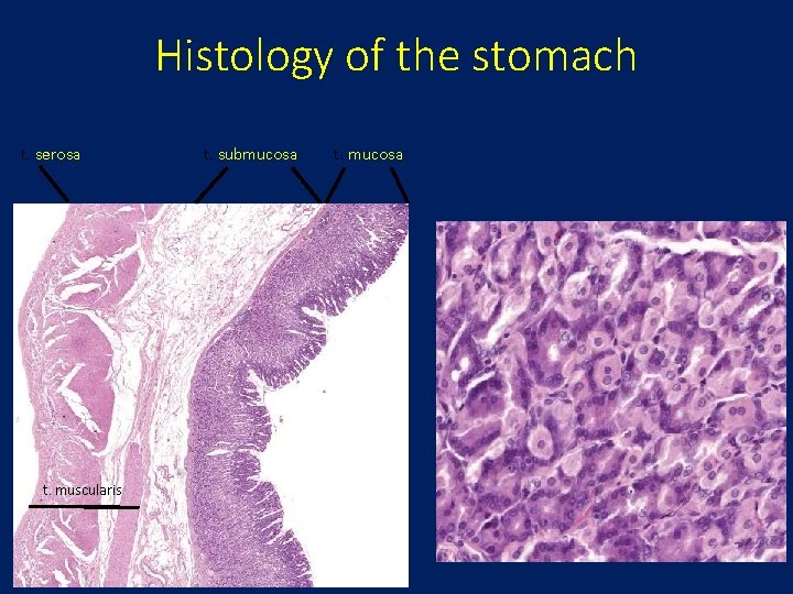Histology of the stomach t. serosa t. muscularis t. submucosa t. mucosa 