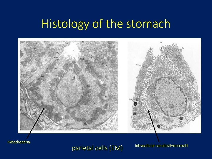 Histology of the stomach mitochondria parietal cells (EM) intracellular canaliculi+microvilli 