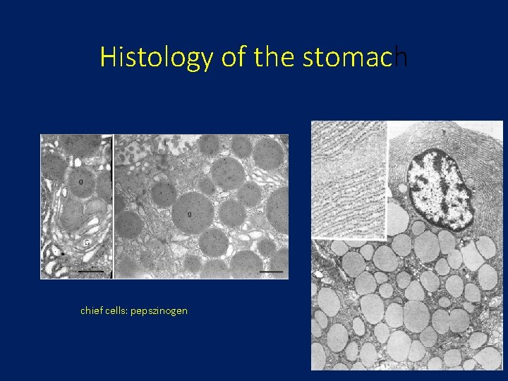 Histology of the stomach chief cells: pepszinogen 