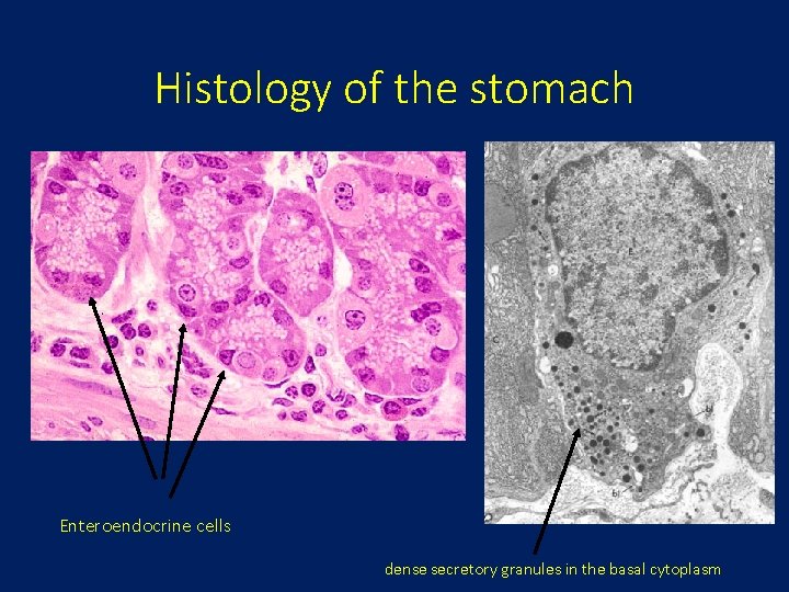 Histology of the stomach Enteroendocrine cells dense secretory granules in the basal cytoplasm 