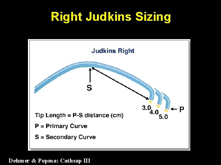 Right Judkins Sizing Dehmer & Popma: Cathsap III 