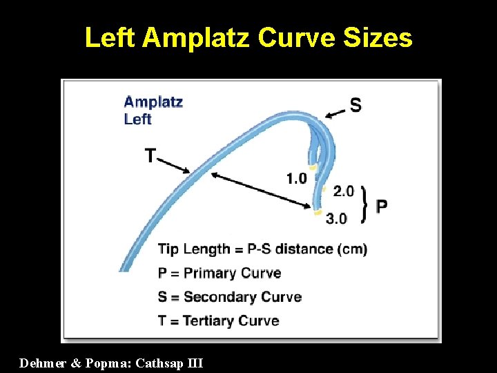 Left Amplatz Curve Sizes Dehmer & Popma: Cathsap III 