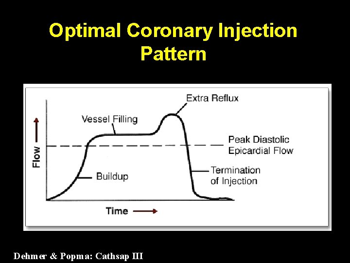 Optimal Coronary Injection Pattern Dehmer & Popma: Cathsap III 