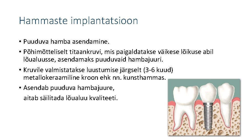 Hammaste implantatsioon • Puuduva hamba asendamine. • Põhimõtteliselt titaankruvi, mis paigaldatakse väikese lõikuse abil